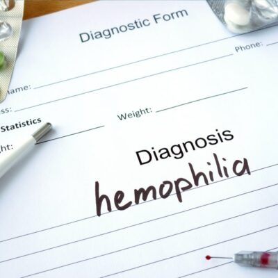 Here’s what to eat for hemophilia
